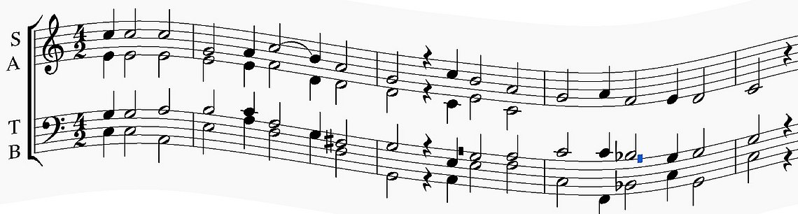 Abschrift Posaunenchoralbuch 362I